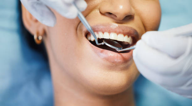 Best Emergency Dental Care for Broken or Chipped Teeth in Pond Creek, OK